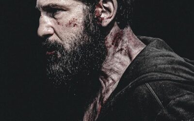 Bring me the head of Frank Castiglione!